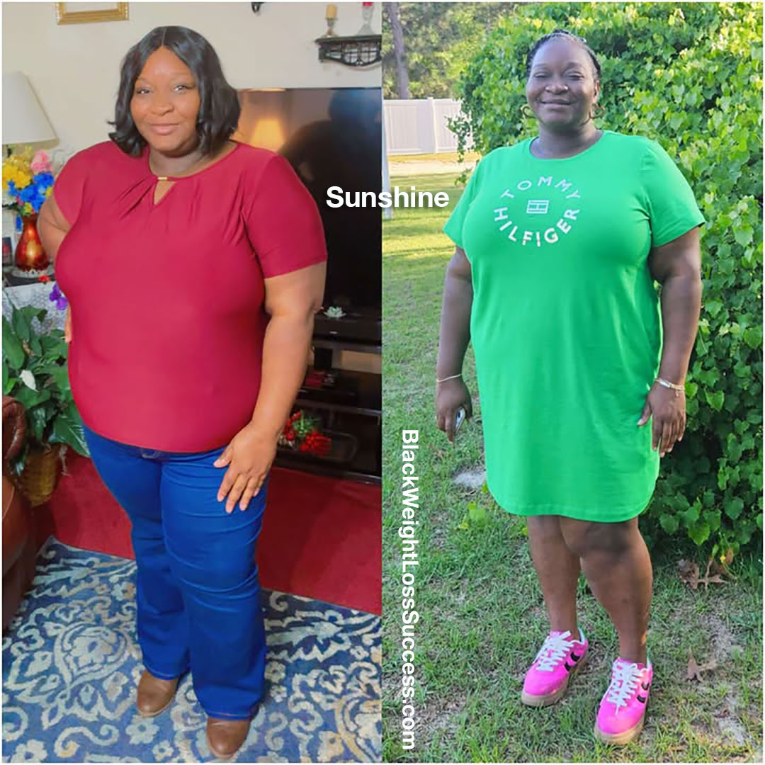 sunshine before and after weight loss